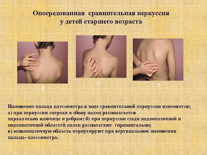 Опосредованная сравнительная перкуссия у детей старшего возраста в б б Положение пальца плессиметра в