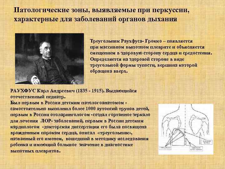 Патологические зоны, выявляемые при перкуссии, характерные для заболеваний органов дыхания Треугольник Раухфуса- Грокко –
