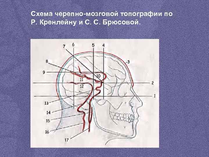 Схема черепно мозговой топографии кренлейна