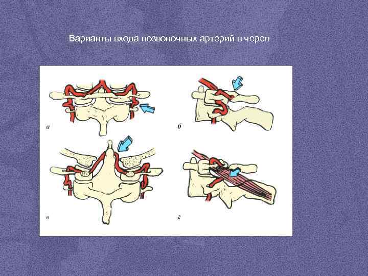 Позвоночные артерии v2 d s