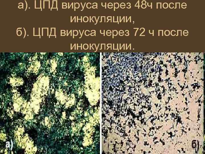 а). ЦПД вируса через 48 ч после инокуляции, б). ЦПД вируса через 72 ч