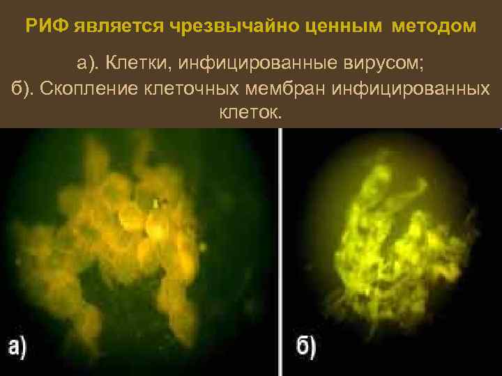 РИФ является чрезвычайно ценным методом а). Клетки, инфицированные вирусом; б). Скопление клеточных мембран инфицированных