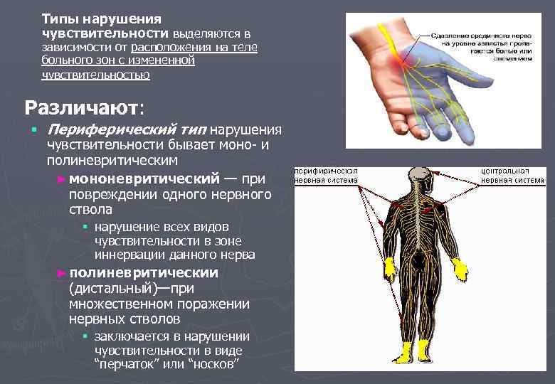 Типы нарушения чувствительности выделяются в зависимости от расположения на теле больного зон с измененной