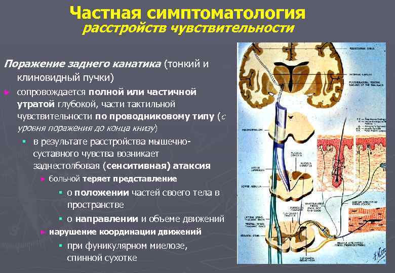 Внутренняя капсула анатомия клиническая картина поражения