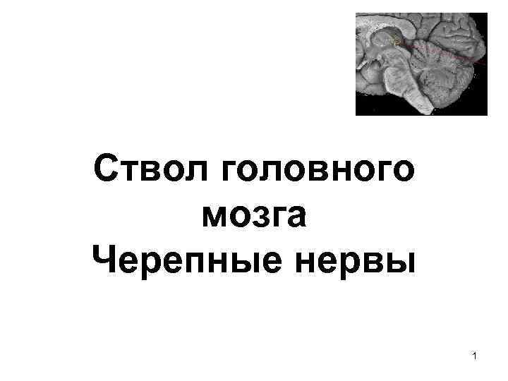 Ствол головного мозга Черепные нервы 1 