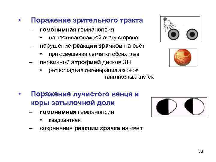 Прямая реакция зрачка на свет