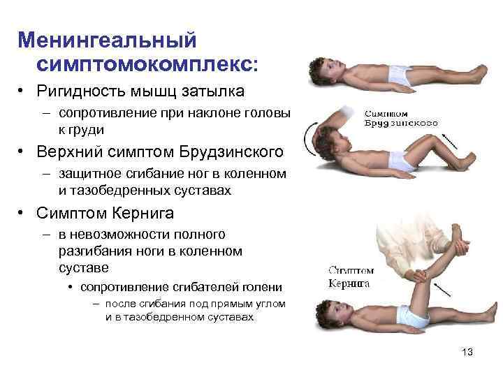 Менингеальный симптомокомплекс: • Ригидность мышц затылка – сопротивление при наклоне головы к груди •