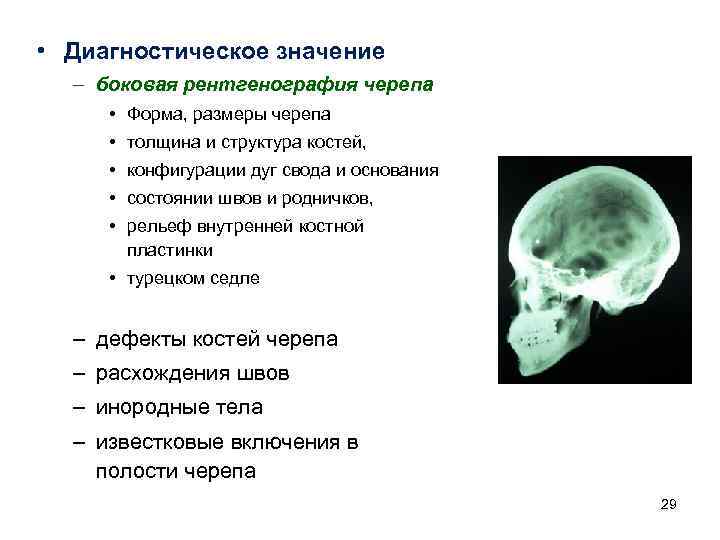  • Диагностическое значение – боковая рентгенография черепа • Форма, размеры черепа • толщина