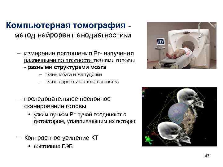 Компьютерная томография метод нейрорентгенодиагностики – измерение поглощения Рг- излучения различными по плотности тканями головы