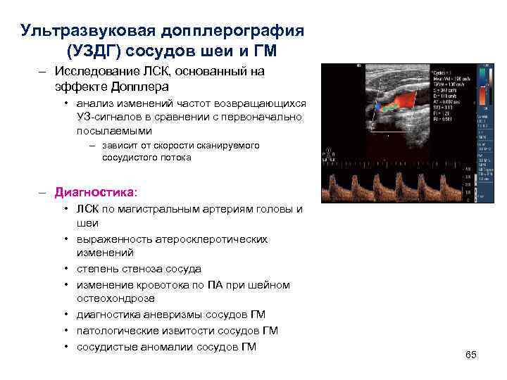 Ультразвуковая допплерография (УЗДГ) сосудов шеи и ГМ – Исследование ЛСК, основанный на эффекте Допплера