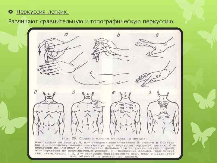 Перкуссия легких сравнительная и топографическая