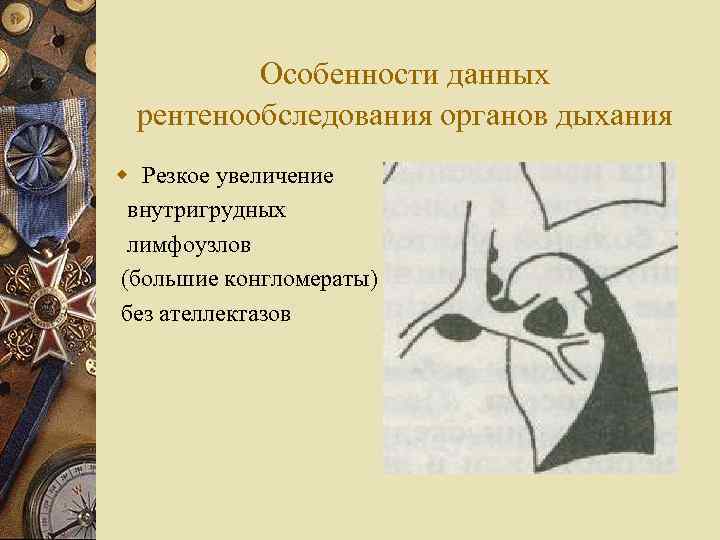 Особенности данных рентенообследования органов дыхания w Резкое увеличение внутригрудных лимфоузлов (большие конгломераты) без ателлектазов