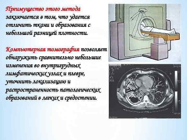 Преимущество этого метода заключается в том, что удается отличить ткани и образования с небольшой