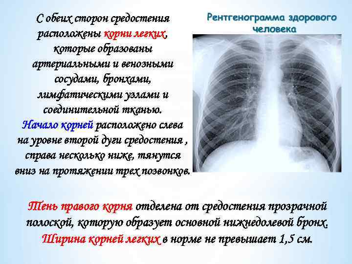 С обеих сторон средостения расположены корни легких, которые образованы артериальными и венозными сосудами, бронхами,