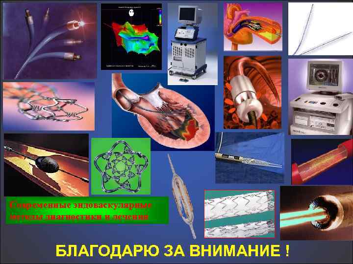 Современные эндоваскулярные методы диагностики и лечения БЛАГОДАРЮ ЗА ВНИМАНИЕ ! 