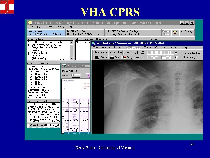 VHA CPRS Denis Protti - University of Victoria 34 