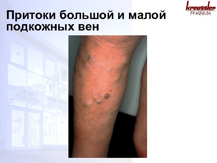 Притоки большой и малой подкожных вен 