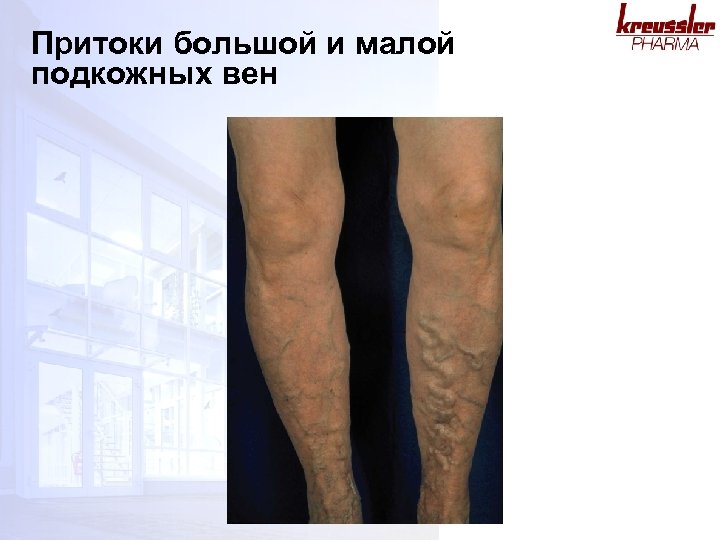 Притоки большой и малой подкожных вен 