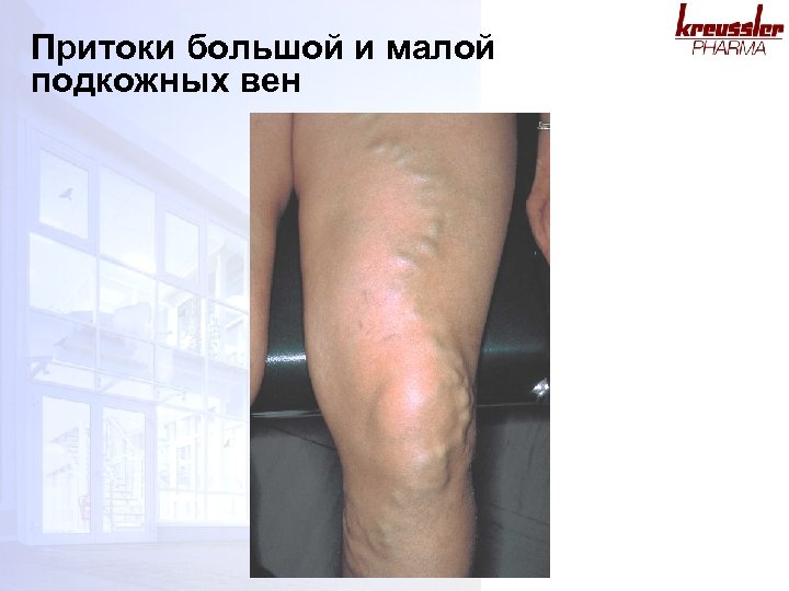 Притоки большой и малой подкожных вен 