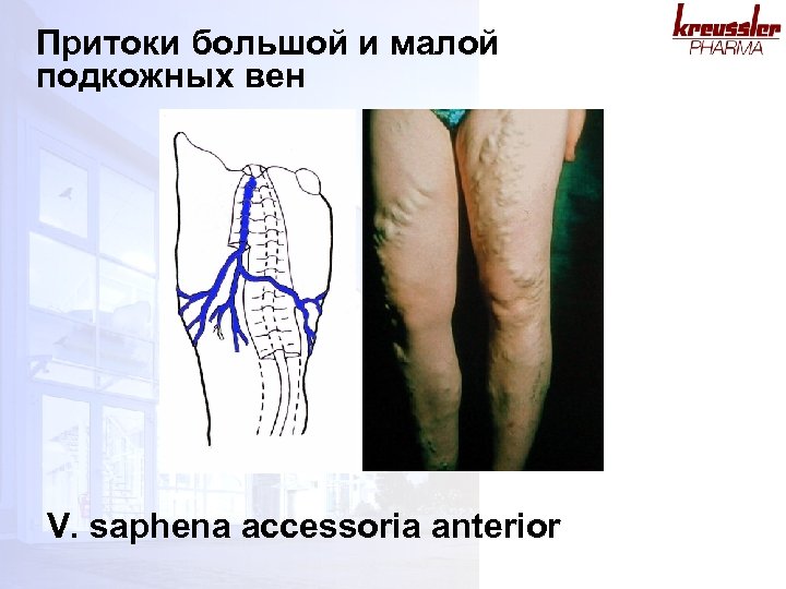 Притоки большой и малой подкожных вен V. saphena accessoria anterior 