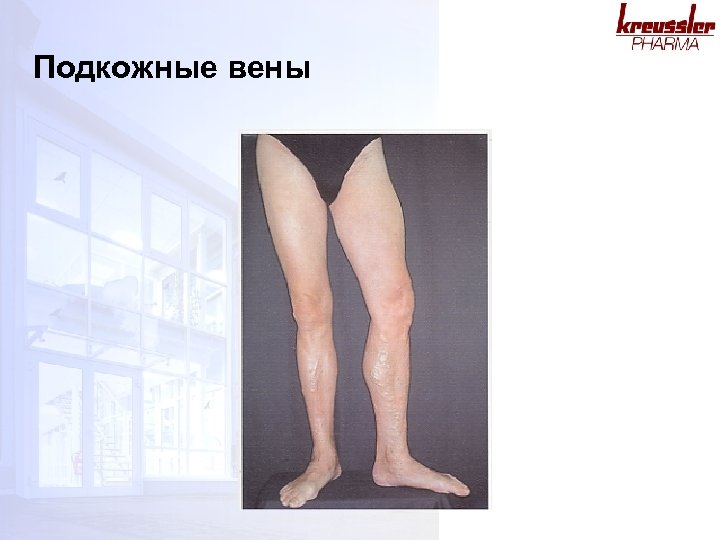 Подкожные вены 