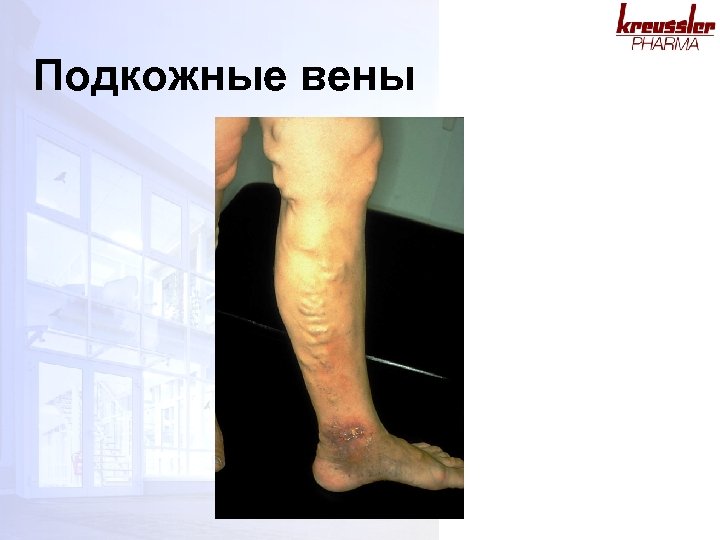 Подкожные вены 