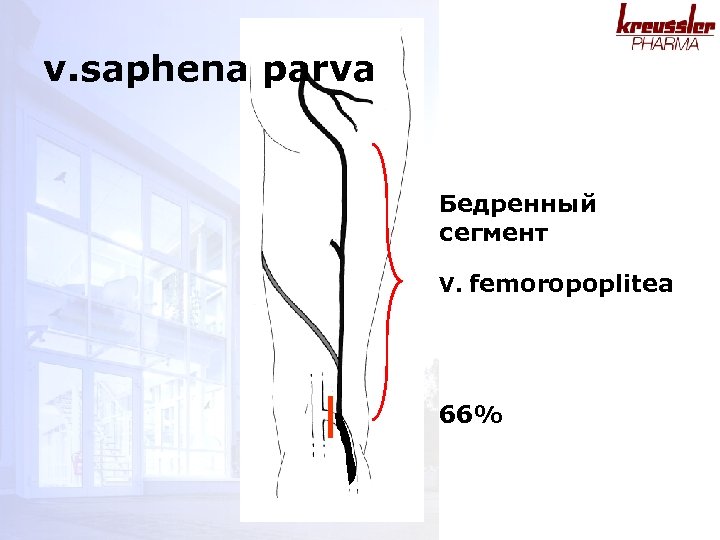 v. saphena parva Бедренный сегмент V. femoropoplitea 66% 
