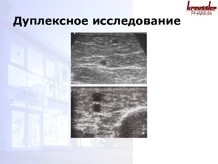 Дуплексное исследование 