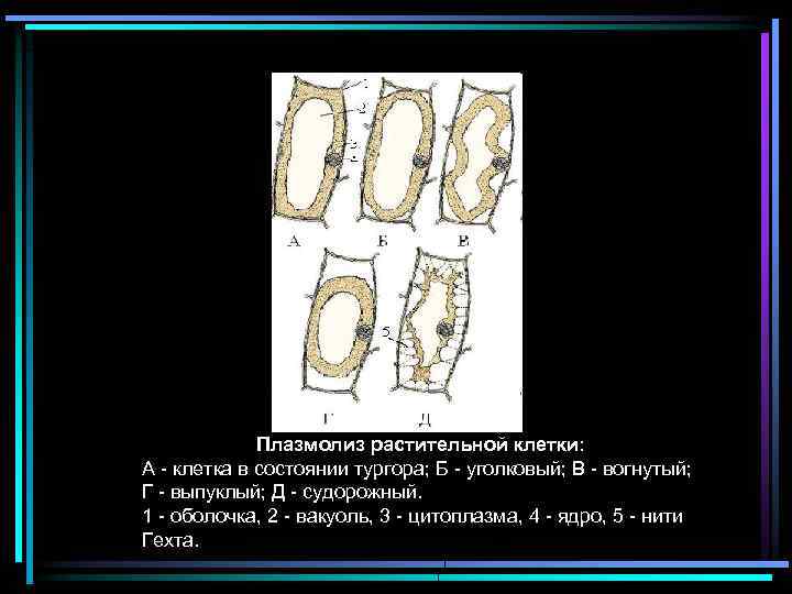 Плазмолиз растительной клетки: А - клетка в состоянии тургора; Б - уголковый; В -