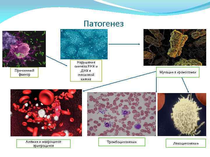 Патогенез Причинный фактор Анемия и макроцитоз эритроцитов Нарушение синтеза РНК и ДНК в стволовой