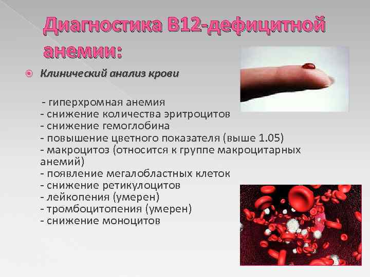 Диагностика В 12 -дефицитной анемии: Клинический анализ крови - гиперхромная анемия - снижение количества