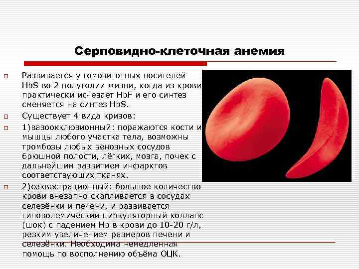Серповидноклеточная анемия какая. Синдром при серповидноклеточной анемии. Серповидноклеточная анемия этиология. Серповидно клеточная анемия картина крови. Серповидноклеточная анемия клиническая картина.