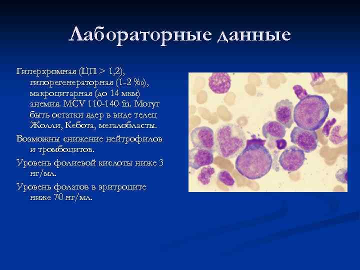 Клетки с гиперхромными ядрами. Мегалобласты норма в крови. Гиперхромная мегалобластная анемия. Анализ при гиперхромной анемии. Гипо и гиперхромная анемия.