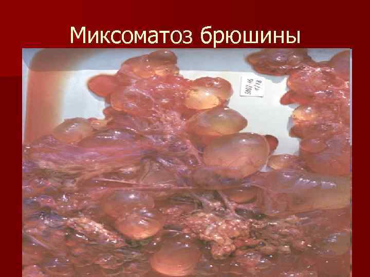 Миксоматоз брюшины 