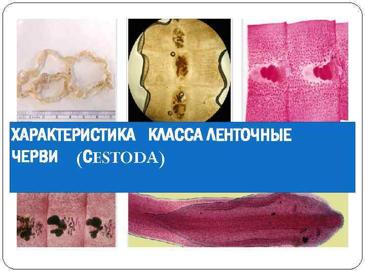 ХАРАКТЕРИСТИКА КЛАССА ЛЕНТОЧНЫЕ ЧЕРВИ (СESTODA) 