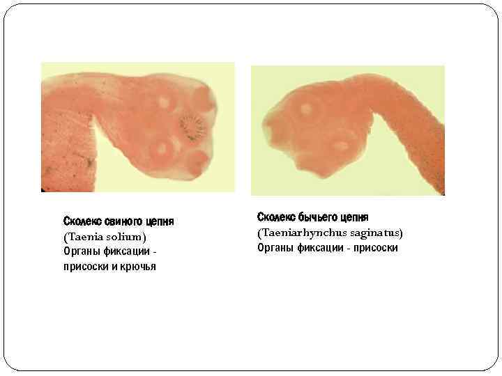 Сколекс свиного цепня (Taenia solium) Органы фиксации присоски и крючья Сколекс бычьего цепня (Taeniarhynchus