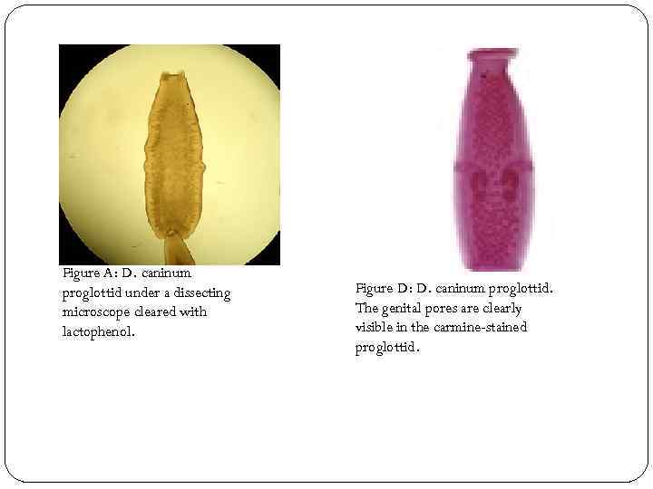 Figure A: D. caninum proglottid under a dissecting microscope cleared with lactophenol. Figure D: