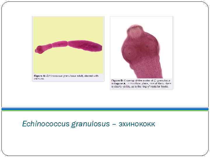 Echinococcus granulosus – эхинококк 