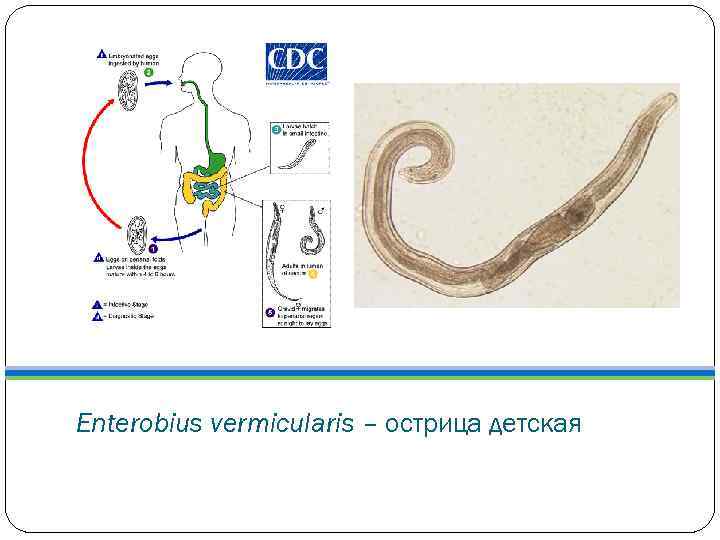 Enterobius vermicularis – острица детская 