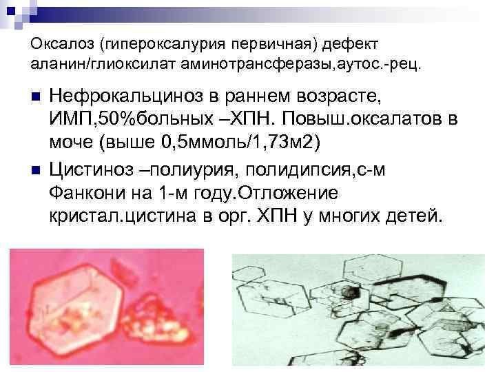 Оксалоз (гипероксалурия первичная) дефект аланин/глиоксилат аминотрансферазы, аутос. -рец. n n Нефрокальциноз в раннем возрасте,