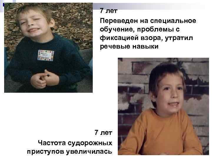 7 лет Переведен на специальное обучение, проблемы с фиксацией взора, утратил речевые навыки 7