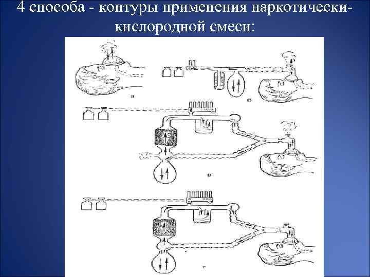 4 способа - контуры применения наркотическикислородной смеси: 