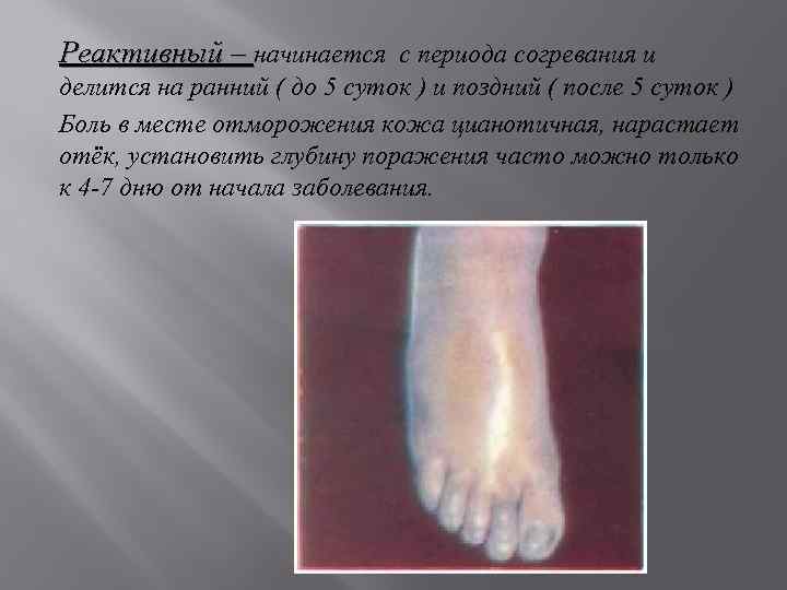Реактивный – начинается с периода согревания и делится на ранний ( до 5 суток