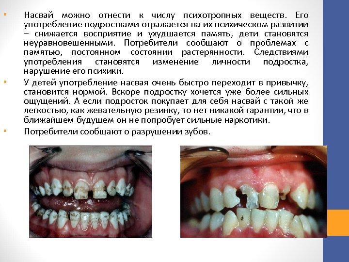  • • • Насвай можно отнести к числу психотропных веществ. Его употребление подростками