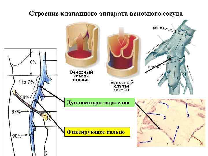 Строение клапанного аппарата венозного сосуда Дупликатура эндотелия Фиксирующее кольцо 