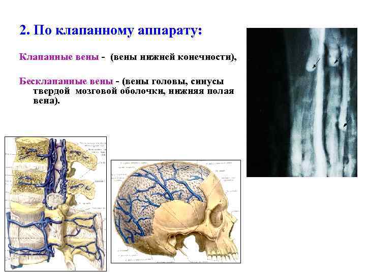 2. По клапанному аппарату: Клапанные вены - (вены нижней конечности), Бесклапанные вены - (вены