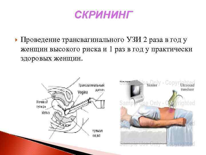 Узи матки и придатков трансвагинально