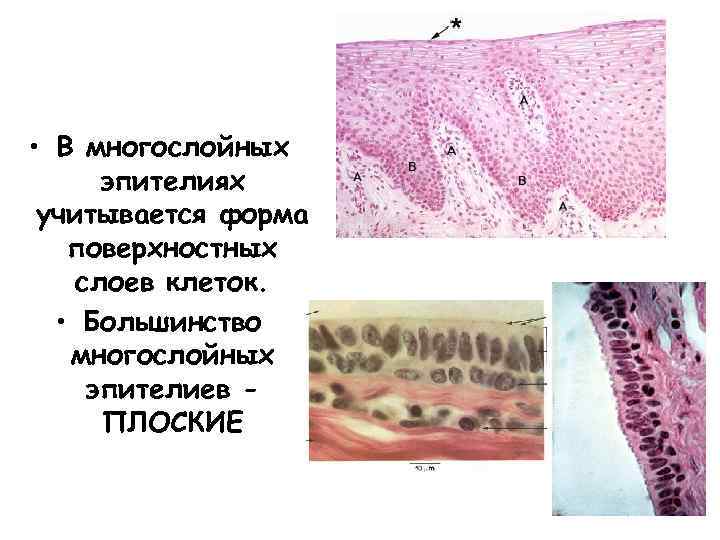  • В многослойных эпителиях учитывается форма поверхностных слоев клеток. • Большинство многослойных эпителиев