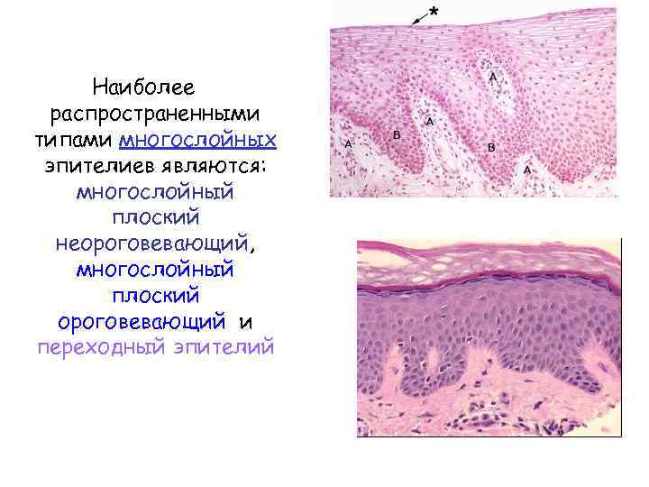 Наиболее распространенными типами многослойных эпителиев являются: многослойный плоский неороговевающий, многослойный плоский ороговевающий и переходный