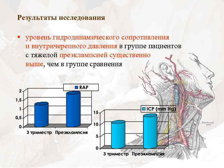 Результаты исследования § уровень гидродинамического сопротивления и внутричерепного давления в группе пациентов с тяжелой